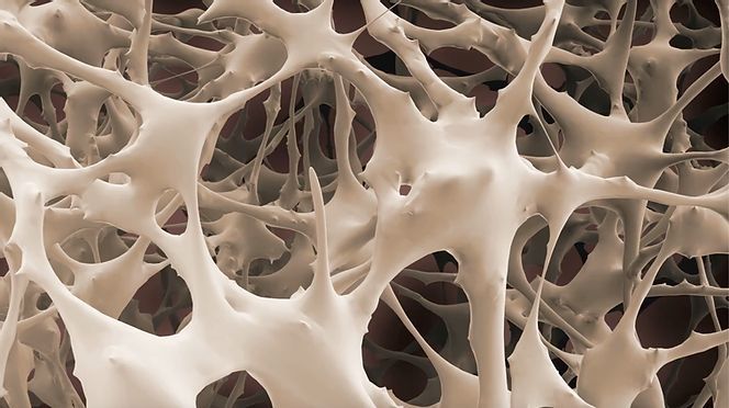 Osteoconductive Architecture  Osteoconductive Architecture in Cancellous Bone Graft