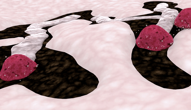 Osteoblasts Remodel Bone  Osteoblasts in Cancellous Bone Graft